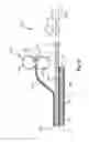 Fig. 11 - ABSORBENT ARTICLE COMPRISING A TOPSHEET/ACQUISITION LAYER LAMINATE