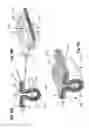 Fig. 20 - ABSORBENT ARTICLE COMPRISING A TOPSHEET/ACQUISITION LAYER LAMINATE