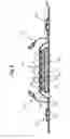 Fig. 07 - ABSORBENT ARTICLE COMPRISING A TOPSHEET/ACQUISITION LAYER LAMINATE