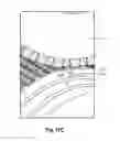 Fig. 20 - ABSORBENT ARTICLE COMPRISING A TOPSHEET/ACQUISITION LAYER LAMINATE