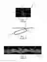 Fig. 02 - Absorbent Articles