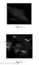 Fig. 05 - Absorbent Articles