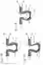 Fig. 10 - Absorbent Articles