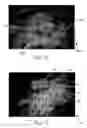 Fig. 11 - Absorbent Articles