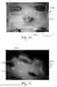 Fig. 12 - Absorbent Articles