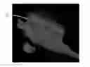 Fig. 01 - Nonwoven material having discrete three-dimensional deformations with wide base openings that are base bonded to additional layer