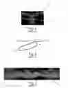 Fig. 02 - Nonwoven material having discrete three-dimensional deformations with wide base openings that are base bonded to additional layer
