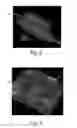 Fig. 05 - Nonwoven material having discrete three-dimensional deformations with wide base openings that are base bonded to additional layer