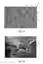 Fig. 08 - Nonwoven material having discrete three-dimensional deformations with wide base openings that are base bonded to additional layer