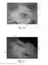 Fig. 12 - Nonwoven material having discrete three-dimensional deformations with wide base openings that are base bonded to additional layer