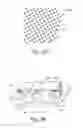 Fig. 29 - Nonwoven material having discrete three-dimensional deformations with wide base openings that are base bonded to additional layer