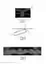 Fig. 02 - Nonwoven material having discrete three-dimensional deformations with wide base openings