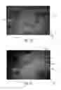 Fig. 11 - Nonwoven material having discrete three-dimensional deformations with wide base openings