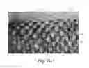 Fig. 14 - Nonwoven material having discrete three-dimensional deformations with wide base openings