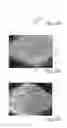 Fig. 17 - Nonwoven material having discrete three-dimensional deformations with wide base openings