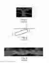 Fig. 02 - Nonwoven material having discrete three-dimensional deformations with wide base openings and specific fiber concentrations