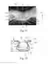 Fig. 07 - Nonwoven material having discrete three-dimensional deformations with wide base openings and specific fiber concentrations