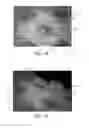 Fig. 12 - Nonwoven material having discrete three-dimensional deformations with wide base openings and specific fiber concentrations