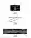 Fig. 02 - Nonwoven Material Having Discrete Three-Dimensional Deformations Forming Protrusions Having A Varying Width And Wide Base Openings