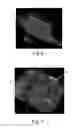 Fig. 05 - Nonwoven Material Having Discrete Three-Dimensional Deformations Forming Protrusions Having A Varying Width And Wide Base Openings