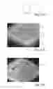 Fig. 17 - Nonwoven Material Having Discrete Three-Dimensional Deformations Forming Protrusions Having A Varying Width And Wide Base Openings