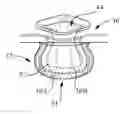 Fig. 01 - Nonwoven Material Having Discrete Three-Dimensional Deformations With Wide Base Openings That are Tip Bonded to Additional Layer