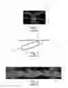 Fig. 02 - Nonwoven Material Having Discrete Three-Dimensional Deformations With Wide Base Openings That are Tip Bonded to Additional Layer