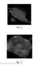 Fig. 05 - Nonwoven Material Having Discrete Three-Dimensional Deformations With Wide Base Openings That are Tip Bonded to Additional Layer