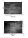 Fig. 11 - Nonwoven Material Having Discrete Three-Dimensional Deformations With Wide Base Openings That are Tip Bonded to Additional Layer