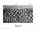 Fig. 14 - Nonwoven Material Having Discrete Three-Dimensional Deformations With Wide Base Openings That are Tip Bonded to Additional Layer