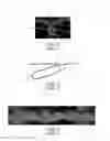 Fig. 02 - Nonwoven material having discrete three-dimensional deformations with differential opacity regions