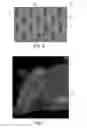 Fig. 04 - Nonwoven material having discrete three-dimensional deformations with differential opacity regions