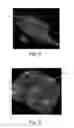 Fig. 05 - Nonwoven material having discrete three-dimensional deformations with differential opacity regions