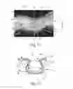 Fig. 07 - Nonwoven material having discrete three-dimensional deformations with differential opacity regions
