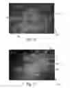 Fig. 11 - Nonwoven material having discrete three-dimensional deformations with differential opacity regions