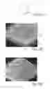 Fig. 17 - Nonwoven material having discrete three-dimensional deformations with differential opacity regions