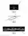Fig. 02 - Absorbent Articles