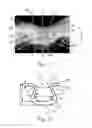 Fig. 07 - Absorbent Articles
