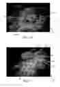 Fig. 11 - Absorbent Articles