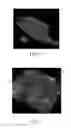Fig. 05 - Absorbent articles with indicia and/or color