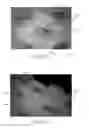 Fig. 12 - Absorbent articles with indicia and/or color