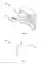 Fig. 10 - Closure locking assembly