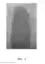Fig. 04 - Producing method of cosmetics composition for a lip tattoo pack and therefrom