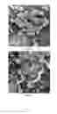 Fig. 02 - Slow and controlled released liposomal gel composition comprising hypoglycemic active ingredient and method of preparing thereof