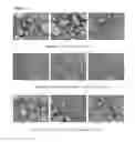 Fig. 02 - PROCESS FOR PREPARING MICROPARTICLES
