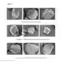 Fig. 03 - PROCESS FOR PREPARING MICROPARTICLES