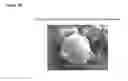 Fig. 05 - PROCESS FOR PREPARING MICROPARTICLES