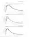Fig. 18 - Methods for overcoming resistance to tramadol