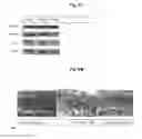 Fig. 09 - Retinopathy treatment