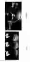 Fig. 06 - Abuse resistant pharmaceutical compositions